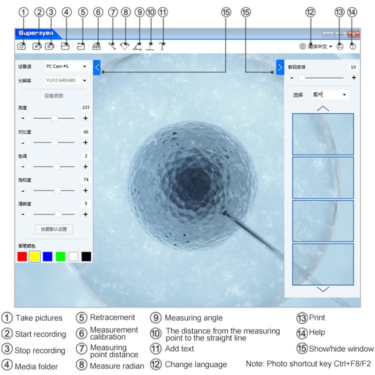 Endoscope photo viewer software screen showing a circular ear image and controls.