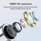 Ear otoscope lens with illuminated viewing elements for clear inspection video.