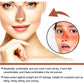 Peach adhesive nose patch on a woman’s nose