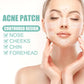 Breathable hydrocolloid acne patch placement guide on nose, cheeks, chin, and forehead