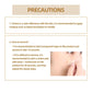 Acne mark covering patch being applied to skin with fingertip