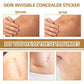 Waterproof skin scar acne mark covering sticker before-and-after on a hand