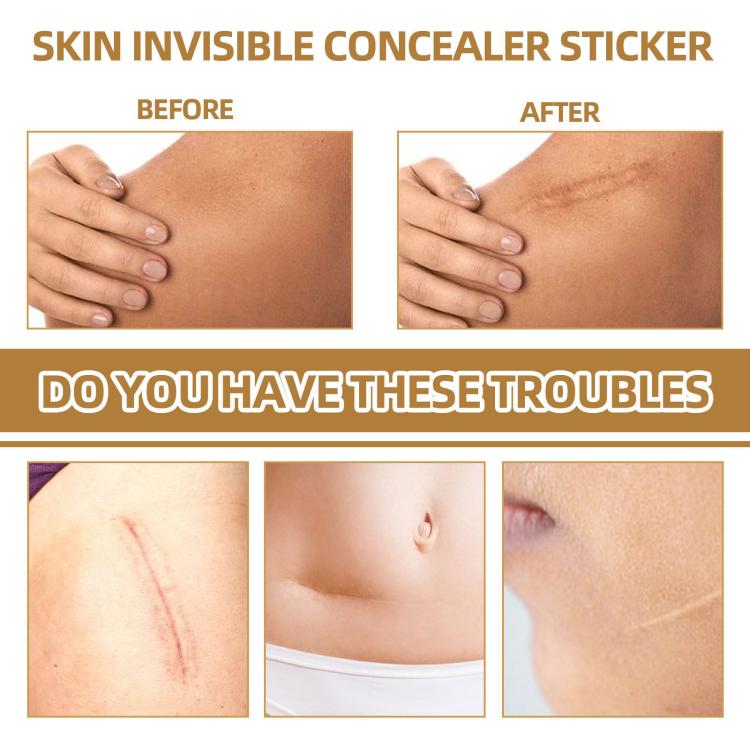 Waterproof skin scar acne mark covering sticker before-and-after on a hand