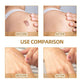 Waterproof skin scar acne mark covering patch applied over a small dark spot