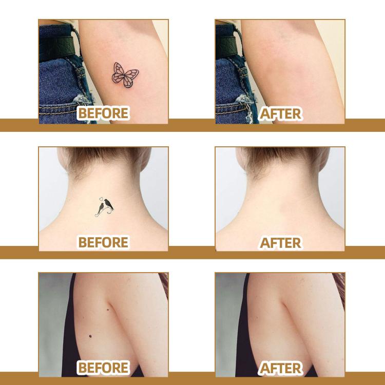 Waterproof skin scar acne mark covering patches on tattooed skin, before and after