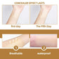 Waterproof skin scar acne mark covering patch effect lasts diagram with breathable finish