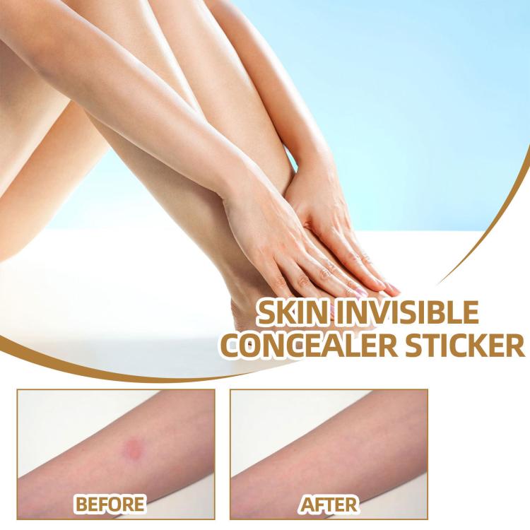 Waterproof skin scar acne mark covering sticker on arm, before and after