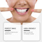 Functional denture set worn in a smile, showing bright white teeth