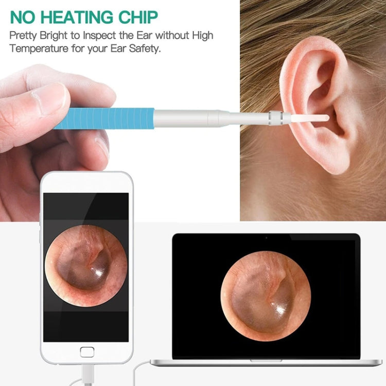 Blue-and-white ear inspection camera tool showing live ear view on smartphone