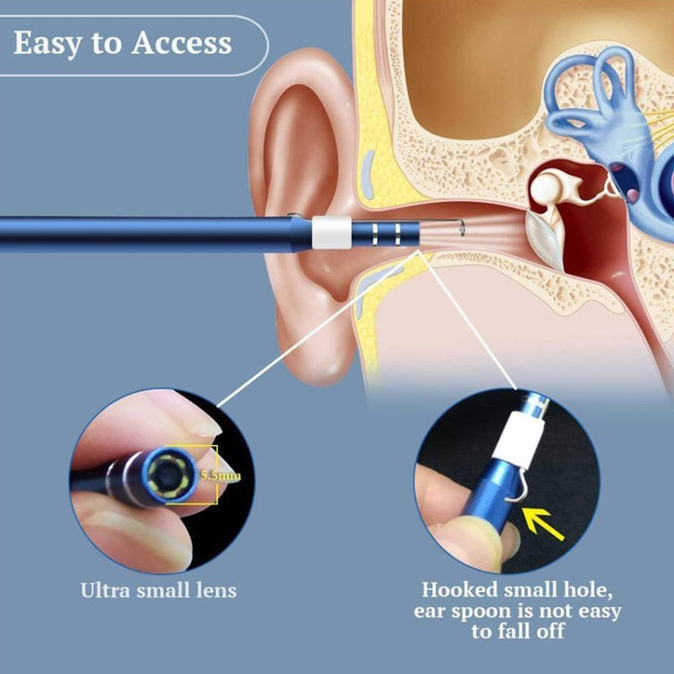Ear inspection camera probe near ear diagram with small lens and hooked ear spoon detail