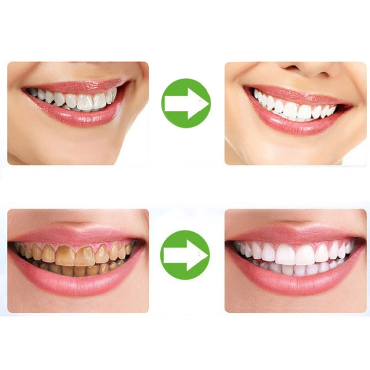 Dental whitening trays concept with smile before-and-after panels