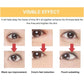 Beauty treatment results infographic with three eye before-and-after panels