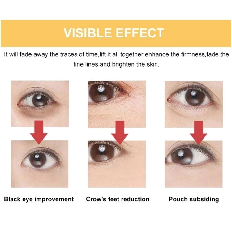 Beauty treatment results infographic with three eye before-and-after panels