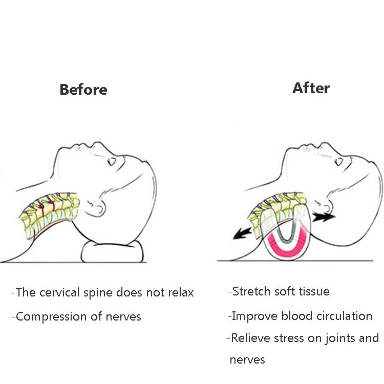 Cervical spine stretching pillow diagram showing before and after neck stretch