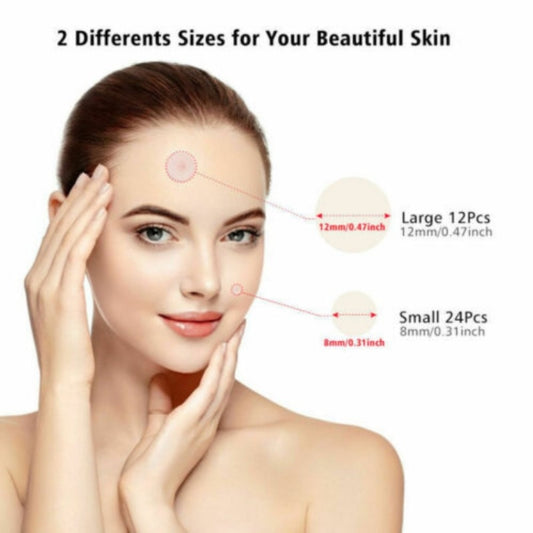 Round acne stickers with size guide on face model, showing small and large patches