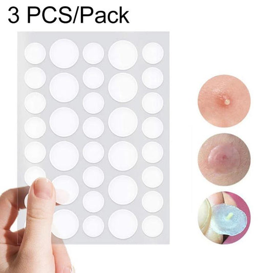 Acne patch set with 3 sheets of round white pimple stickers, shown with picked patch