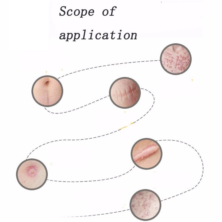 Silicone gel scar therapy patch application chart with skin area inserts