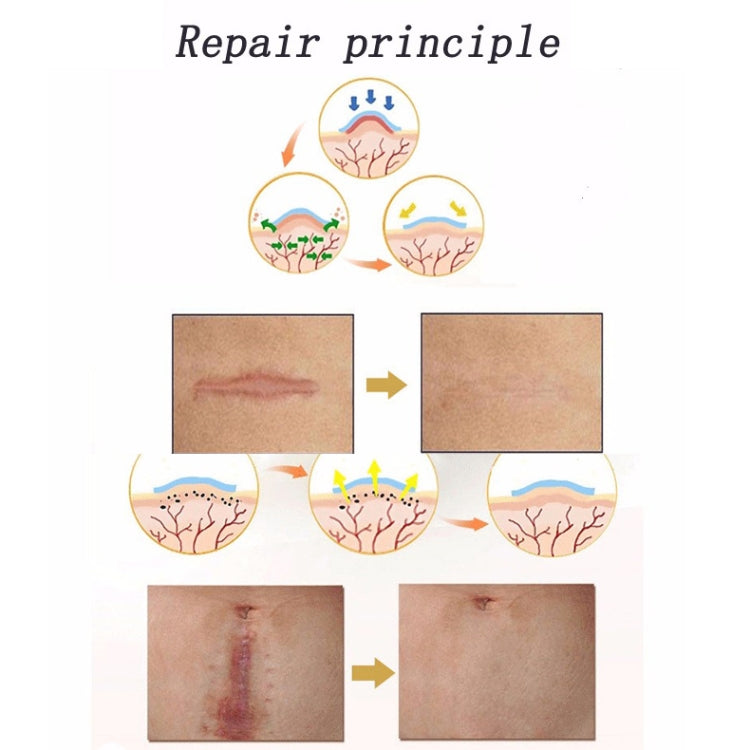 Silicone gel scar therapy patch repair principle diagram with skin before-and-after