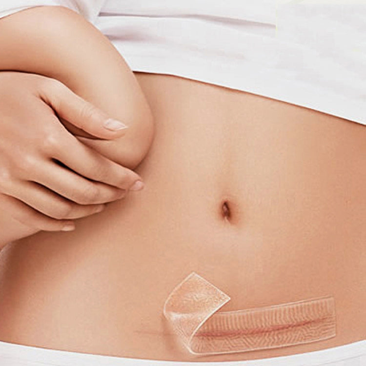Silicone gel scar therapy patch on skin with protective backing removed