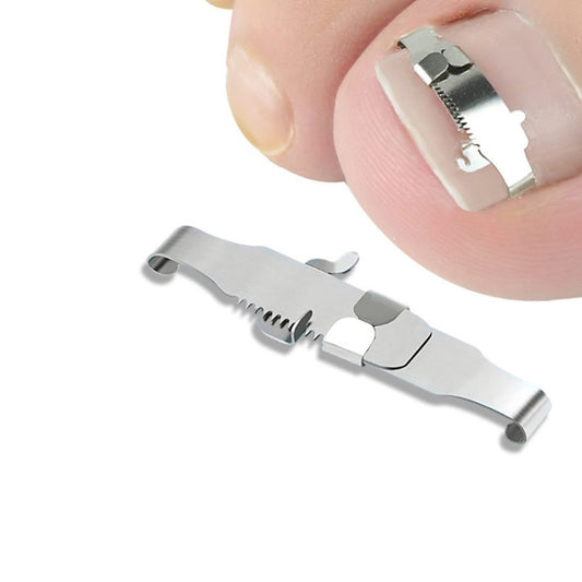 Orthopedic buckle toe nail corrector brace clipped to toenail