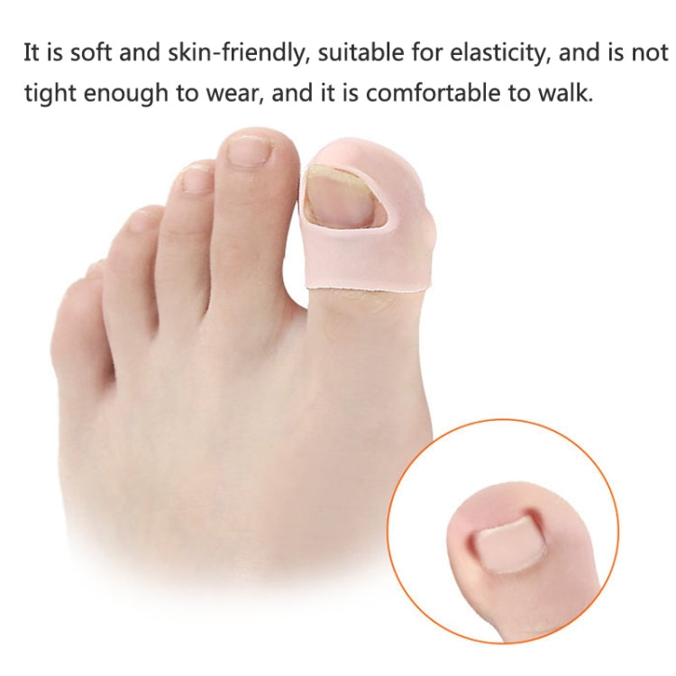 Soft light pink ingrown toenail toe cap on foot with rounded nail opening