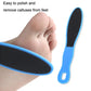 Blue-handled black emery foot file smoothing a bare foot sole