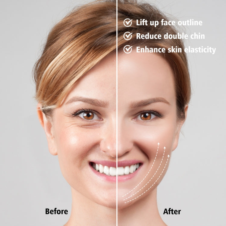 Model wearing a white EMS face-lifting device with dotted contour line guides