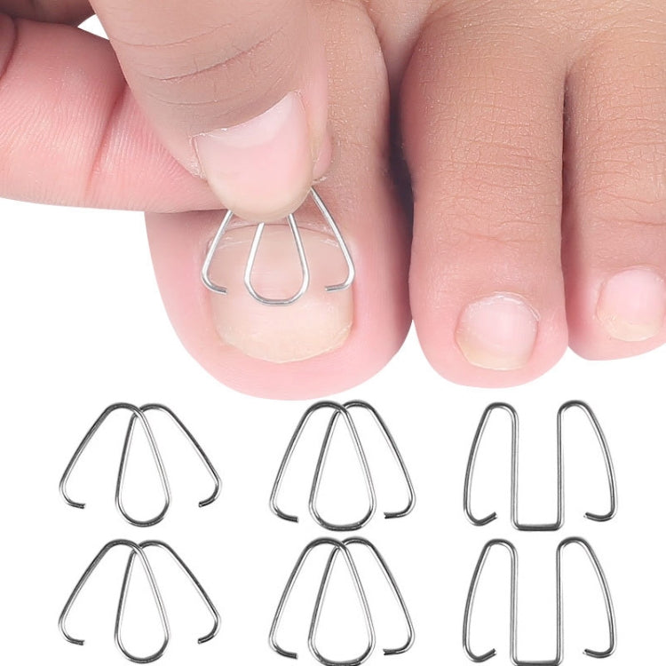 Toe nail orthotic wire hooks and hand placement on toenail