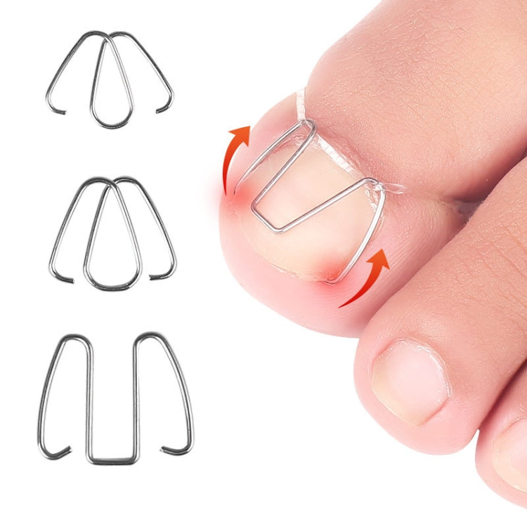 Close-up of hands holding U-shaped toe nail orthotic wire