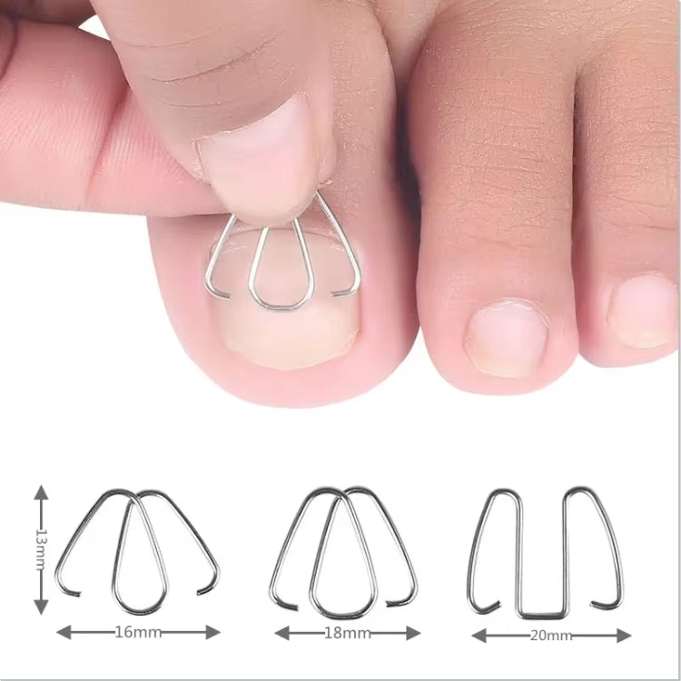 Six toe nail orthotic wire hooks with size markings and insertion